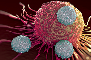 Диагностика Т-клеточного лейкоза